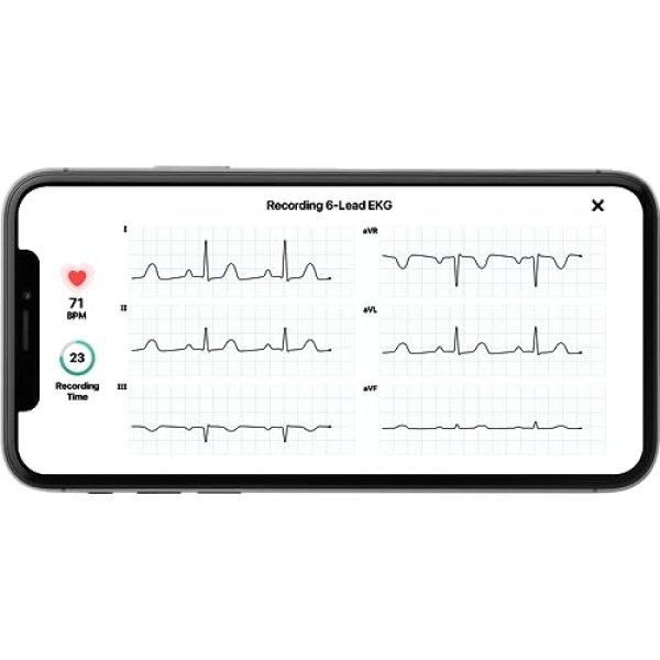 KardiaMobile Six-Lead Personal EKG Monitor - Detect AFib from Home - Image 5